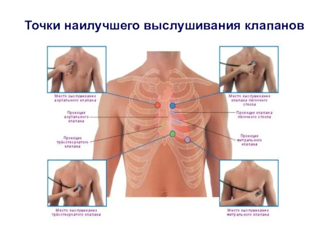 Точки наилучшего выслушивания клапанов