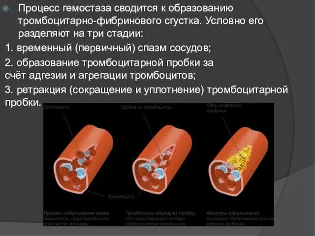 Процесс гемостаза сводится к образованию тромбоцитарно-фибринового сгустка. Условно его разделяют на