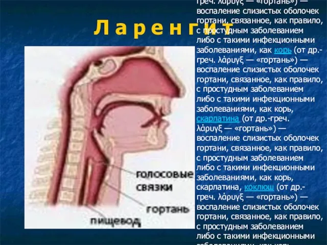 Л а р е н г и т Ларингит (от др.-греч.