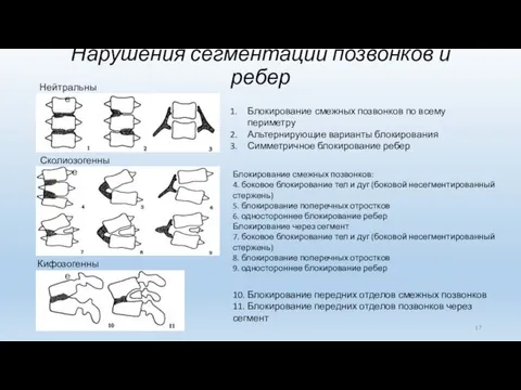 Нарушения сегментации позвонков и ребер Нейтральные Блокирование смежных позвонков по всему