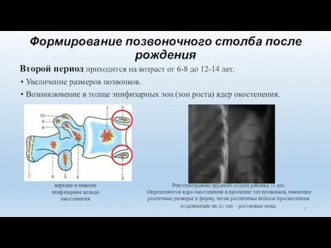 Формирование позвоночного столба после рождения Второй период приходится на возраст от