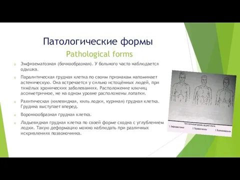 Патологические формы Pathological forms Эмфизематозная (бочкообразная). У больного часто наблюдается одышка.
