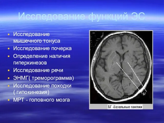 Исследование функций ЭС Исследование мышечного тонуса Исследование почерка Определение наличия гиперкинезов