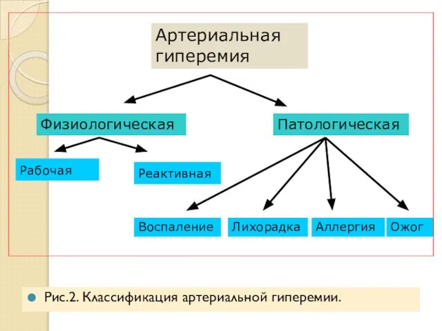 Рис.2. Классификация артериальной гиперемии. Артериальная гиперемия Физиологическая Патологическая Рабочая Реактивная Воспаление Лихорадка Аллергия Ожог