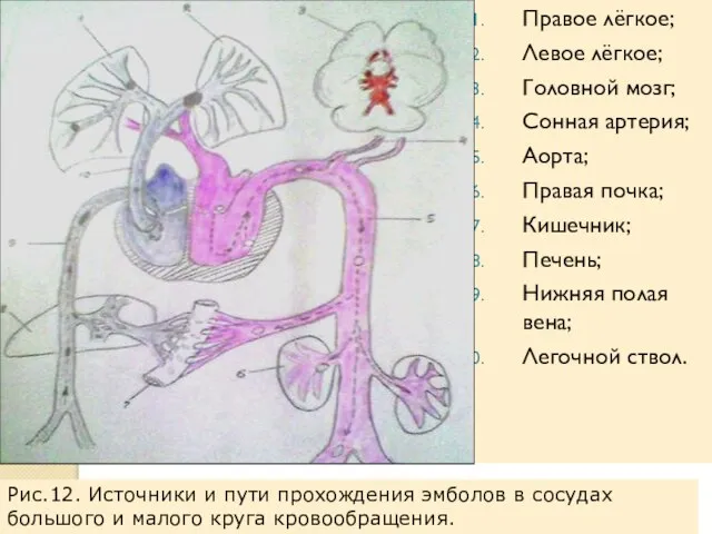 Правое лёгкое; Левое лёгкое; Головной мозг; Сонная артерия; Аорта; Правая почка;