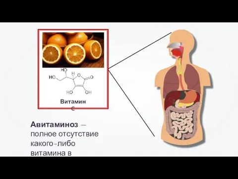 Авитаминоз — полное отсутствие какого-либо витамина в организме. Витамин C