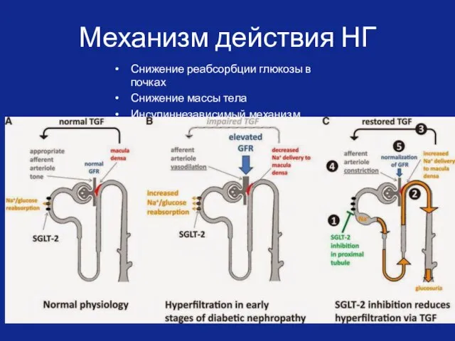 Механизм действия НГ Снижение реабсорбции глюкозы в почках Снижение массы тела Инсулиннезависимый механизм действия