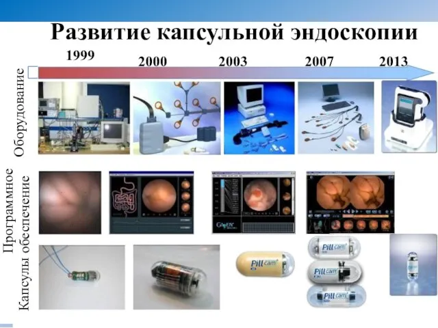 Оборудование Капсулы Программное обеспечение 1999 2007 2000 2003 Развитие капсульной эндоскопии 2013