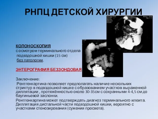 РНПЦ ДЕТСКОЙ ХИРУРГИИ КОЛОНОСКОПИЯ с осмотром терминального отдела подвздошной кишки (15