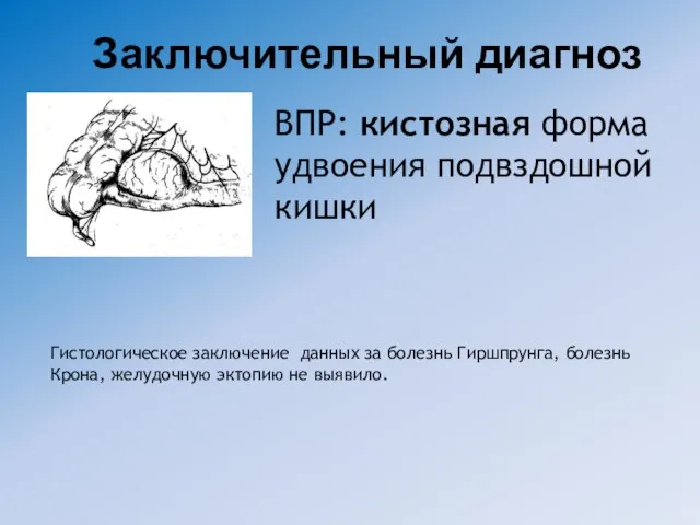 ВПР: кистозная форма удвоения подвздошной кишки Заключительный диагноз Гистологическое заключение данных