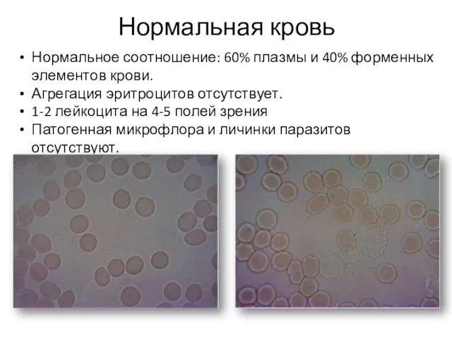 Нормальная кровь Нормальное соотношение: 60% плазмы и 40% форменных элементов крови.