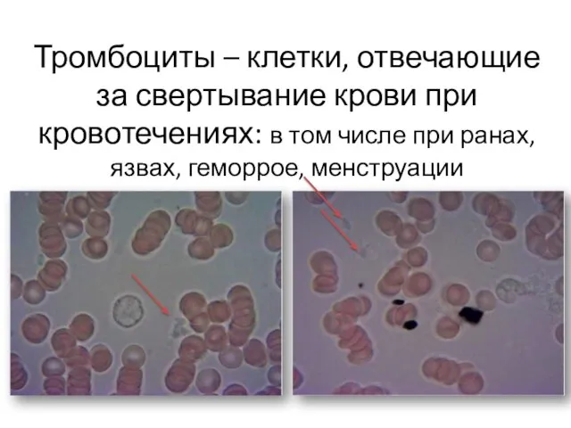 Тромбоциты – клетки, отвечающие за свертывание крови при кровотечениях: в том