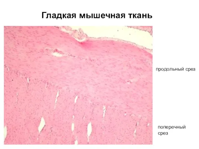 Гладкая мышечная ткань продольный срез поперечный срез