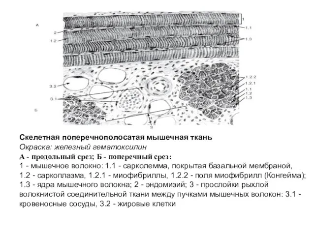 Скелетная поперечнополосатая мышечная ткань Окраска: железный гематоксилин А - продольный срез;