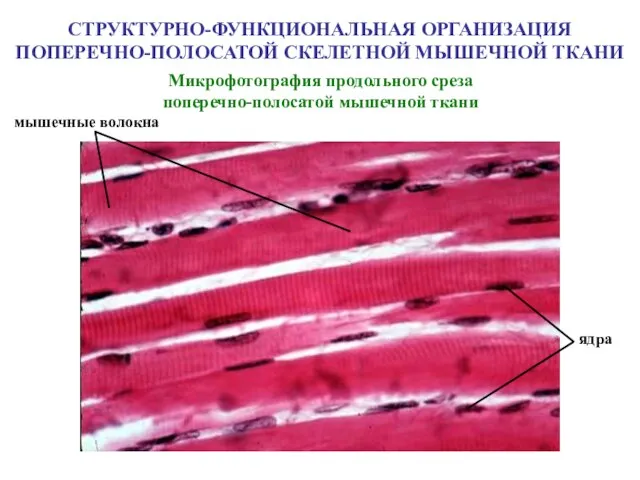 Микрофотография продольного среза поперечно-полосатой мышечной ткани мышечные волокна ядра СТРУКТУРНО-ФУНКЦИОНАЛЬНАЯ ОРГАНИЗАЦИЯ ПОПЕРЕЧНО-ПОЛОСАТОЙ СКЕЛЕТНОЙ МЫШЕЧНОЙ ТКАНИ