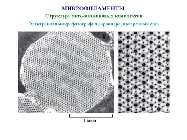 МИКРОФИЛАМЕНТЫ Структура акто-миозиновых комплексов Электронная микрофотография саркомера, поперечный срез 1 мкм