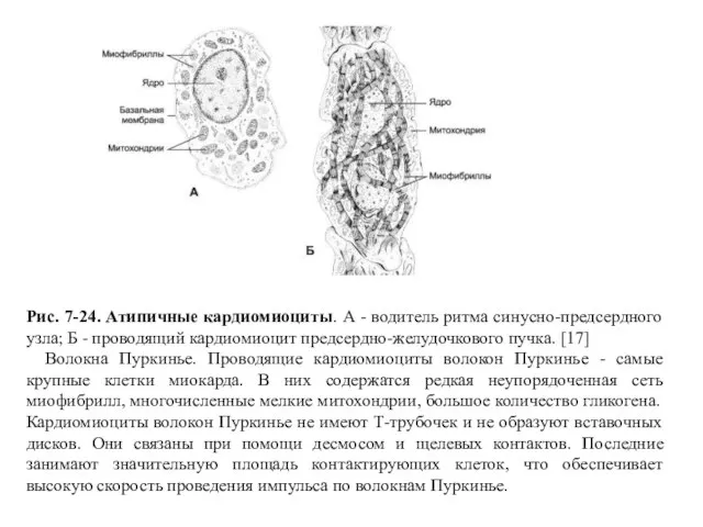 Рис. 7-24. Атипичные кардиомиоциты. А - водитель ритма синусно-предсердного узла; Б