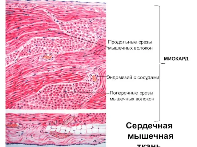 Сердечная мышечная ткань Продольные срезы мышечных волокон Поперечные срезы мышечных волокон Эндомизий с сосудами МИОКАРД