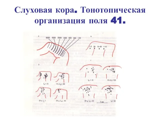 Слуховая кора. Тонотопическая организация поля 41.