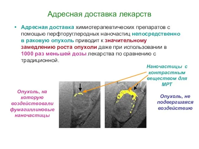 Адресная доставка лекарств Адресная доставка химиотерапевтических препаратов с помощью перфторуглеродных наночастиц