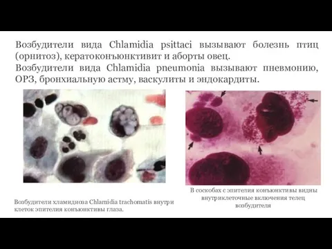 Возбудители вида Chlamidia psittaci вызывают болезнь птиц (орнитоз), кератоконъюнктивит и аборты