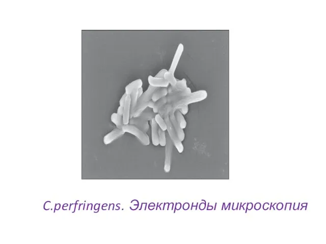 C.perfringens. Электронды микроскопия