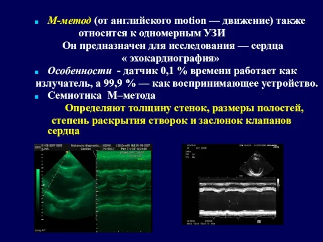 М-метод (от английского motion — движение) также относится к одномерным УЗИ