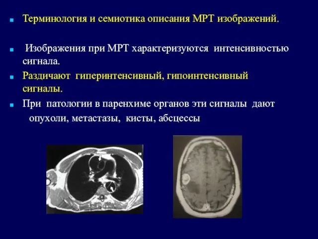 Терминология и семиотика описания МРТ изображений. Изображения при МРТ характеризуются интенсивностью