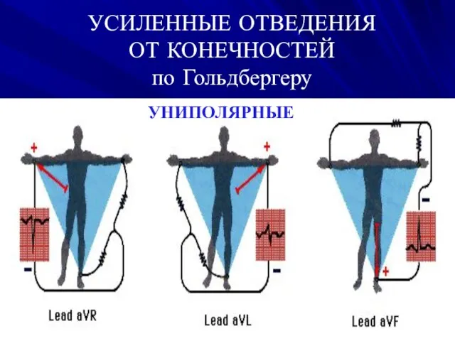 УСИЛЕННЫЕ ОТВЕДЕНИЯ ОТ КОНЕЧНОСТЕЙ по Гольдбергеру‏ УНИПОЛЯРНЫЕ