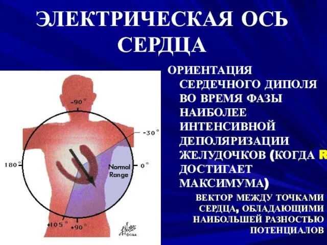 ЭЛЕКТРИЧЕСКАЯ ОСЬ СЕРДЦА ОРИЕНТАЦИЯ СЕРДЕЧНОГО ДИПОЛЯ ВО ВРЕМЯ ФАЗЫ НАИБОЛЕЕ ИНТЕНСИВНОЙ