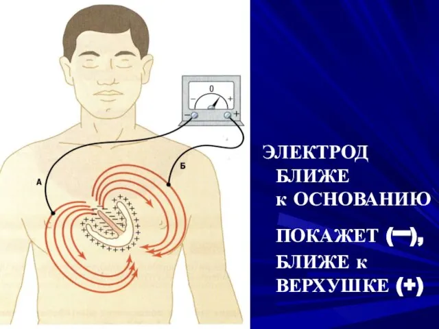 ЭЛЕКТРОД БЛИЖЕ к ОСНОВАНИЮ ПОКАЖЕТ (–), БЛИЖЕ к ВЕРХУШКЕ (+)‏