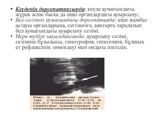 Кеуденің дорсопатиясында: кеуде аумағындағы, жүрек және басқа да ішкі органдардағы ауырсыну;