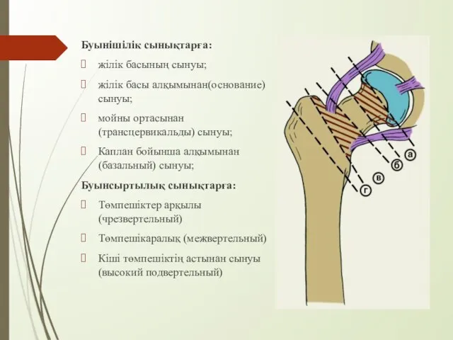 Буынішілік сынықтарға: жілік басының сынуы; жілік басы алқымынан(основание) сынуы; мойны ортасынан