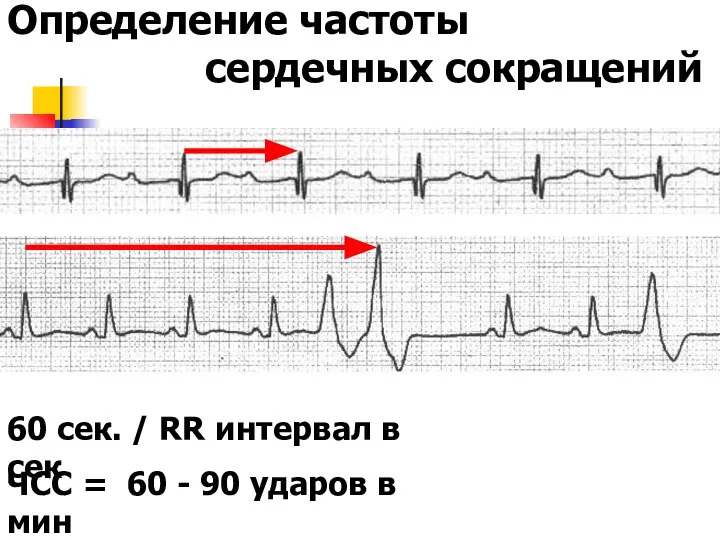 Определение частоты сердечных сокращений 60 сек. / RR интервал в сек