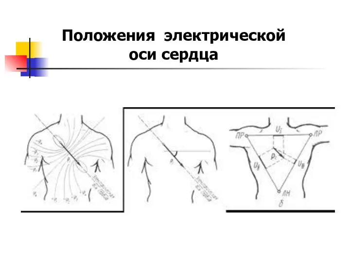 Положения электрической оси сердца