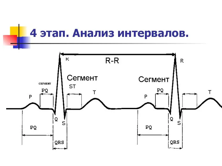 4 этап. Анализ интервалов.