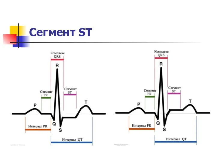 Сегмент ST