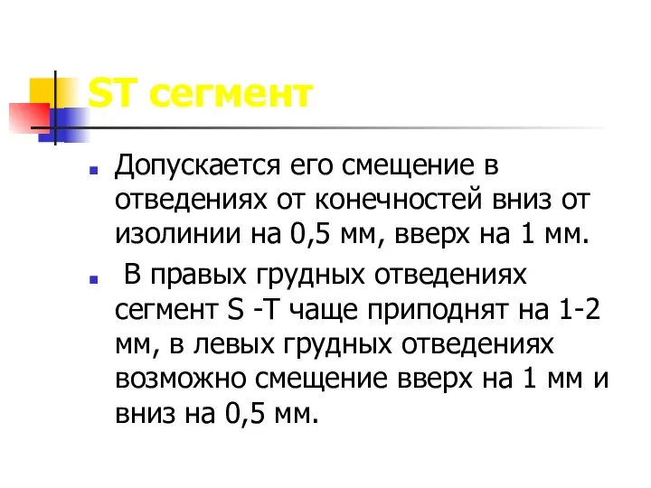 ST сегмент Допускается его смещение в отведениях от конечностей вниз от