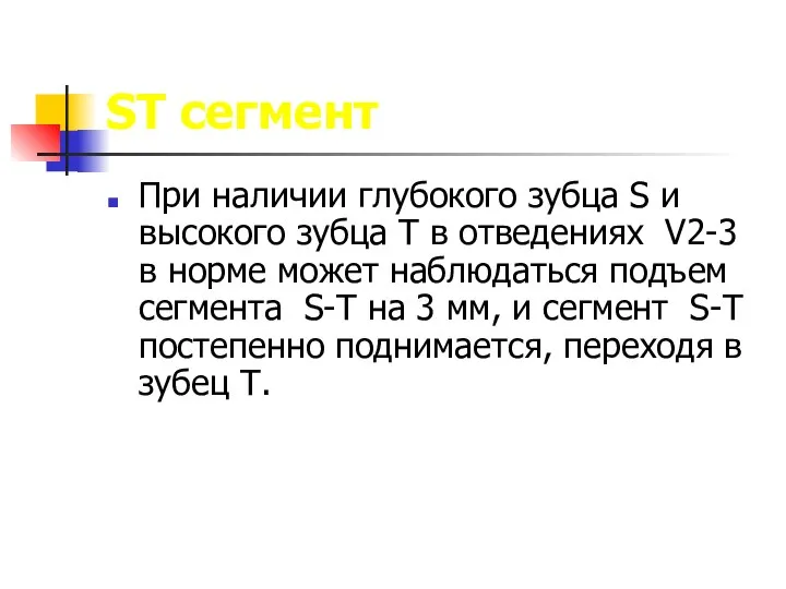 ST сегмент При наличии глубокого зубца S и высокого зубца Т