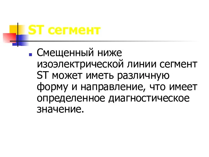 ST сегмент Смещенный ниже изоэлектрической линии сегмент ST может иметь различную