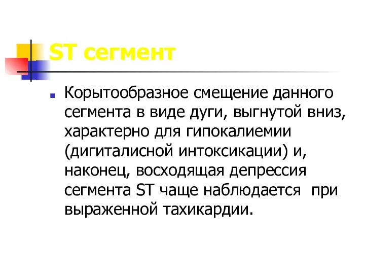 ST сегмент Корытообразное смещение данного сегмента в виде дуги, выгнутой вниз,