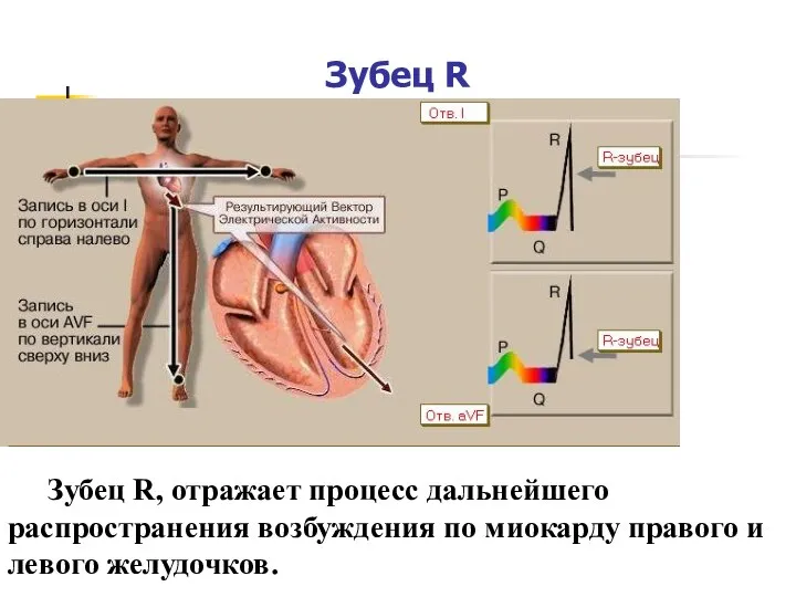 Зубец R Зубец R, отражает процесс дальнейшего распространения возбуждения по миокарду правого и левого желудочков.