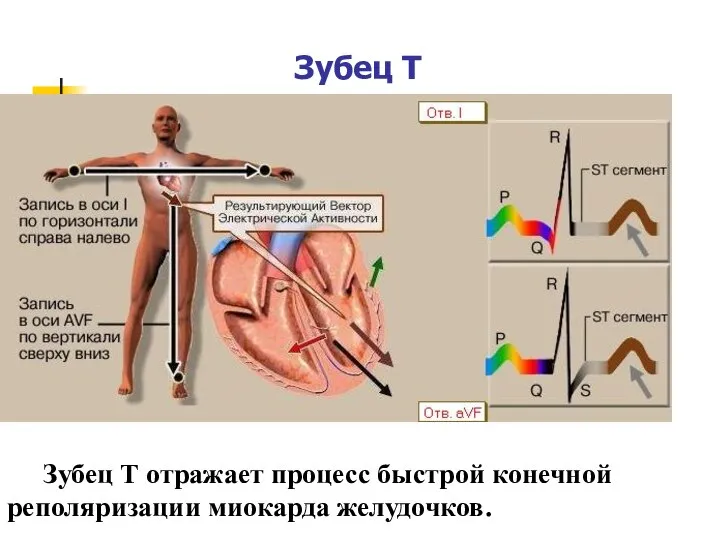 Зубец T Зубец Т отражает процесс быстрой конечной реполяризации миокарда желудочков.