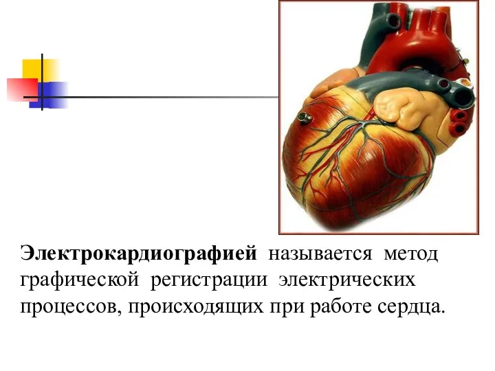 Электрокардиографией называется метод графической регистрации электрических процессов, происходящих при работе сердца.