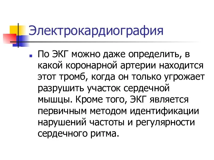 Электрокардиография По ЭКГ можно даже определить, в какой коронарной артерии находится