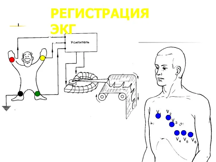 РЕГИСТРАЦИЯ ЭКГ