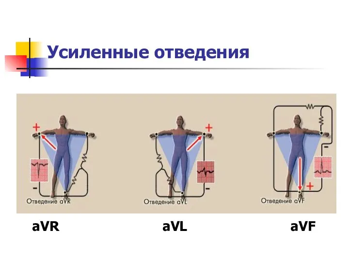 Усиленные отведения aVR aVL aVF