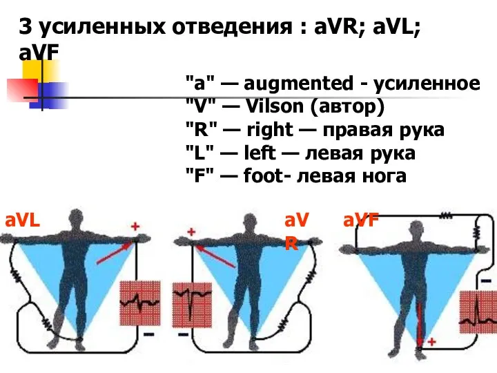 3 усиленных отведения : aVR; aVL; aVF "a" — augmented -