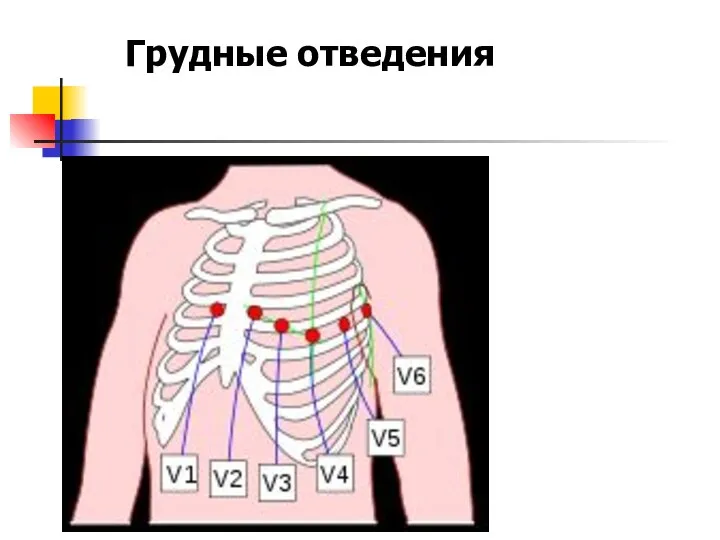 Грудные отведения