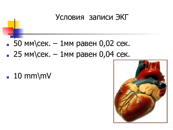 Условия записи ЭКГ 50 мм\сек. – 1мм равен 0,02 сек. 25